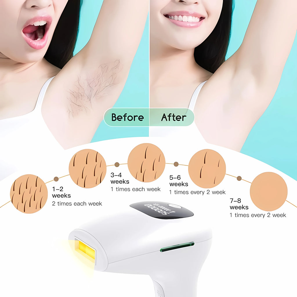 Professional IPL Hair Removal Instrument – 900,000 Flashes, Painless Permanent Hair Reduction for Full Body
